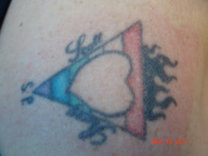 Laser Tattoo Removal