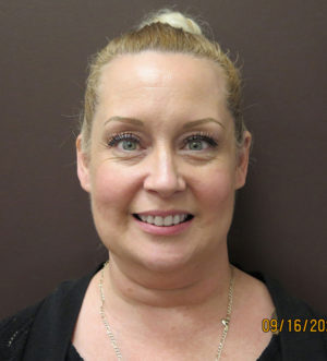 BOTOX® Cosmetic Before & After Photos