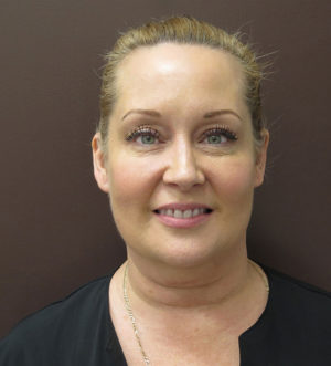 BOTOX® Cosmetic Before & After Photos